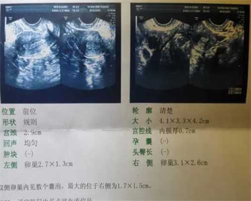 北京潞河医院做试管怎么样 北京哪些医院可以做试管婴儿 ‘15周双顶径和股骨